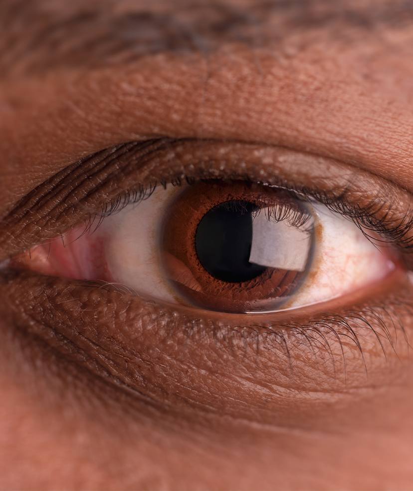 Photo of a person's brown eye