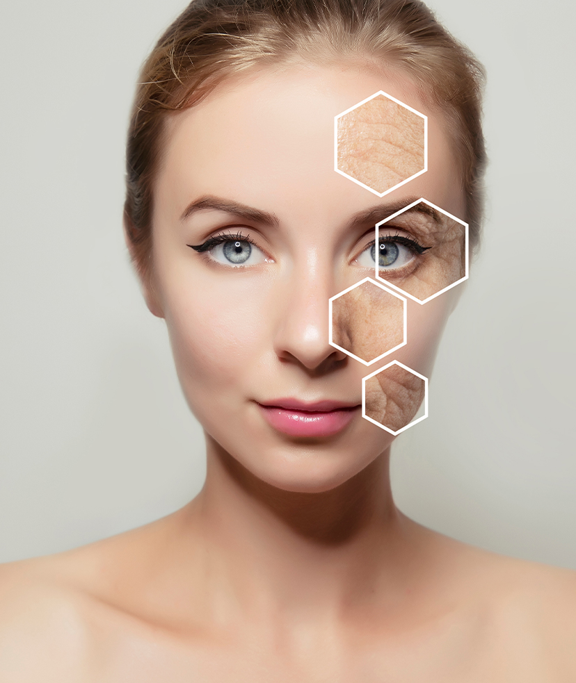 Photo of a woman's face with close-ups on wrinkles and fine lines